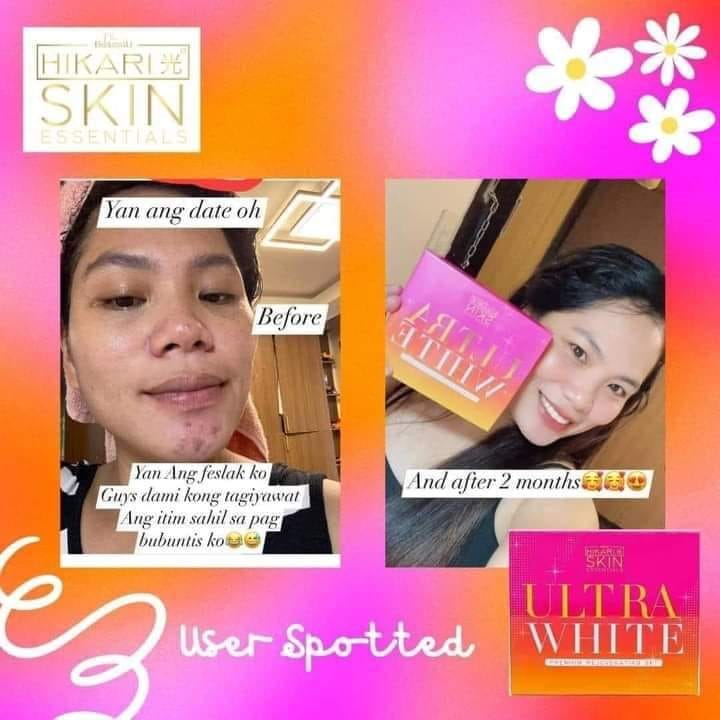 Hikari Skin Essentials Ultra White Premium Rejuv Set, Kojic Soap, Sunscreen