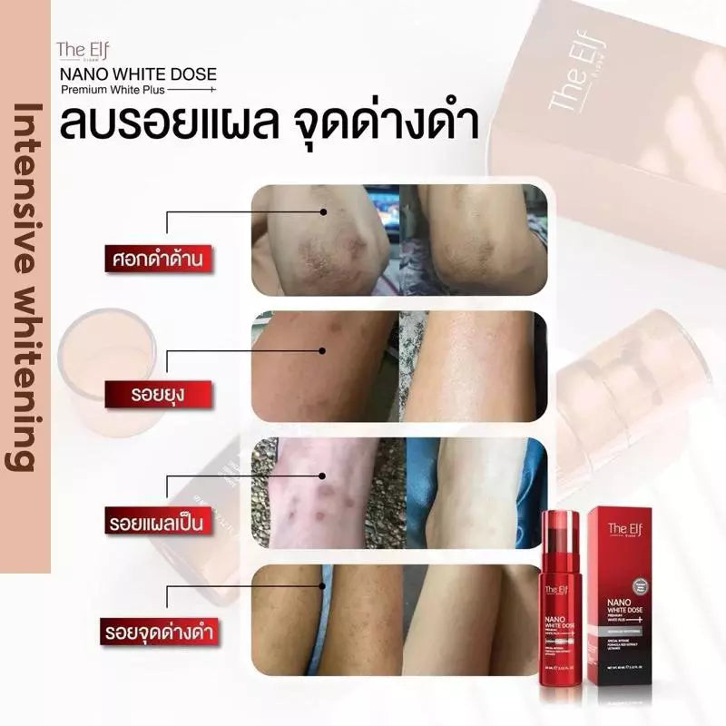 The Elf Nano White Dose Advanced Skin Serum - 60mL