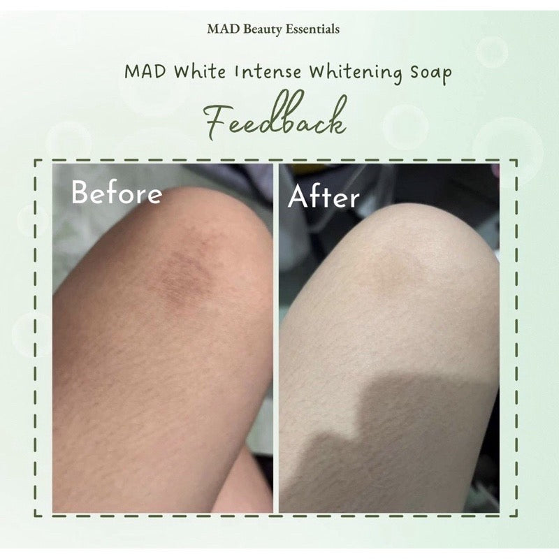 MAD White Intense Whitening Soap for Face and Body Seak Beauty