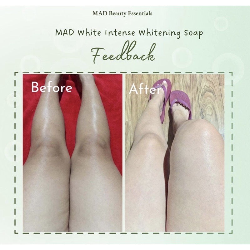 MAD White Intense Whitening Soap for Face and Body